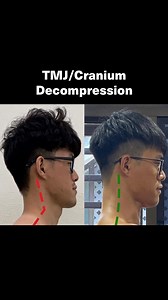 At FP, we have the goods. We dial in the body—the system—first, and the cranium and mandible follow. When you can sprint like a beast (a human one), you start to look like one too. Elite work here by FP HBS @damien.tang_ 👇 “Before FP, my posture would cause me neck pain which lead headaches until nausea. I couldn’t stand for too long due to the hyperextended knees and soreness lower back muscles. I was the skinny, get tired easily, slowest, weakest guy among the people I know. I love to play sp