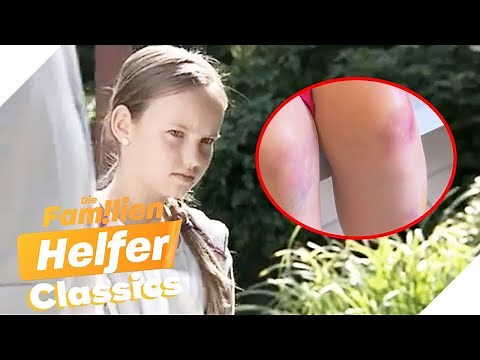 Häusliche Gewalt?! Warum hat die kleine Lotta so viele blaue Flecken? | Die Familienhelfer | SAT.1