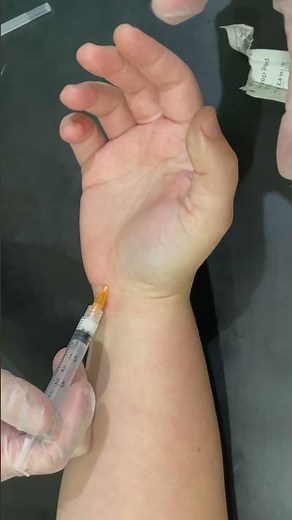 Right Carpal Tunnel Steroid Injection