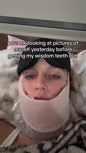 Post-Wisdom Teeth Removal Reflections