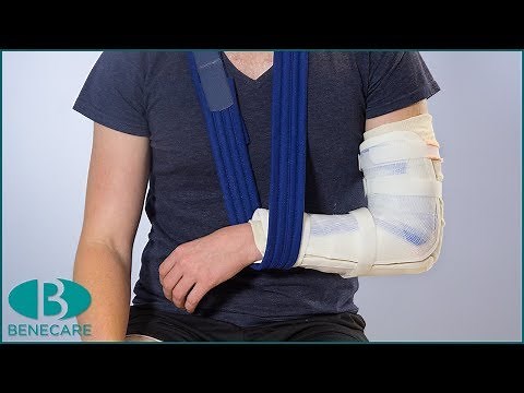 How To Apply a Elbow Drop Out Splint
