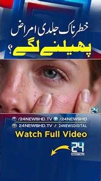 Mobile Causing Skin Problems? How to Protect Your Skin from Winter? Dr Wajeeha Explains - 24 Digital