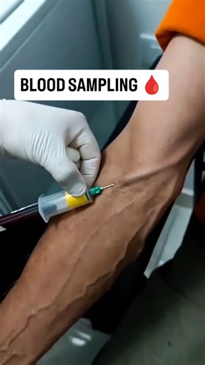 Blood Sampling | Hospital Duty | Nursing Student | #nursing #bloodtest #doctor #viral #shorts #nurse