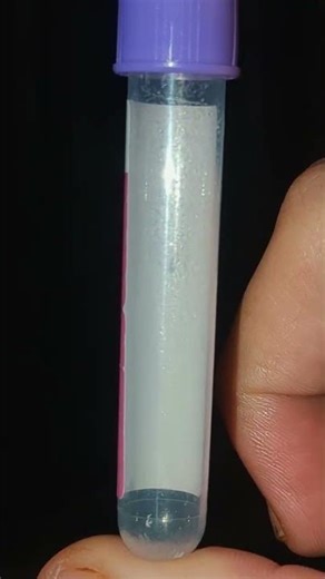 The Most common tube used in Hospital Lab.. #viralvideo #medlab #bloodbank #labresults