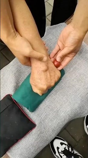 Ganglion Cyst Removal. Everything you need to know.