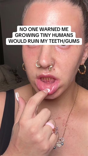 Transform Your Oral Health with Hydroxyapatite