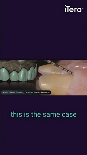 Scanning with a larger field of view* — stronger lab results