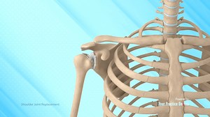 Shoulder Joint Replacement