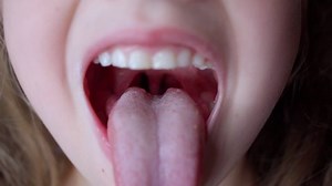 clip-1078096844-girl-opens-her-mouth-wide-pulls-out