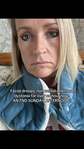 Facial Droop and Hand Dystonia: An FND Sunday Experience