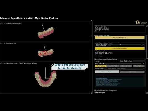 Dental Robot Software