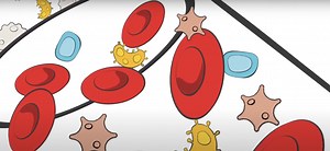 Reduce Fatality Risks with Timely and Accurate Diagnostics | Clinical And Molecular Dx