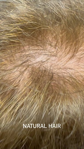 Mesh status I absolutely love offering this service to my clients....