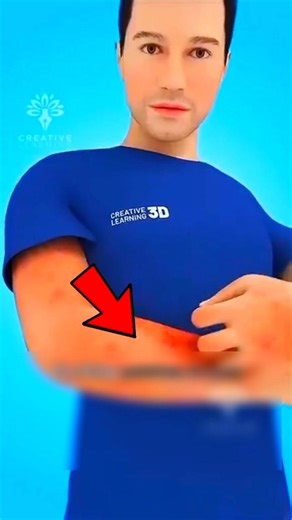 Why You Feel Itchy for No Reason 🤔