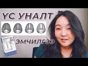 Үс уналтын тухай: Шинж тэмдэг, нөлөөлөгч хүчин зүйлс болон эмчилгээ (BosleyMD)