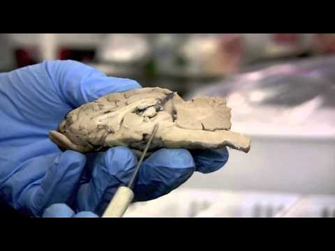 Sheep Brain Dissection Pt. 2 of 2