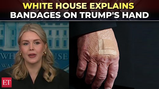 2.7K views · 14 reactions | 爐 #KarolineLeavitt explains #Trump’s #hand #bandages: ‘He’s constantly shaking hands...’ 啕 Catch the day's latest news and updates ➠ https://ecoti.in/z5xODa ️ | The Economic Times | Facebook