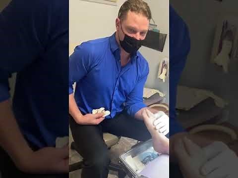 Partial Nail Avulsion