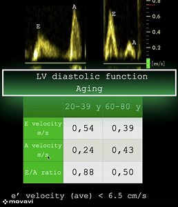 LV diastolic function/Aging