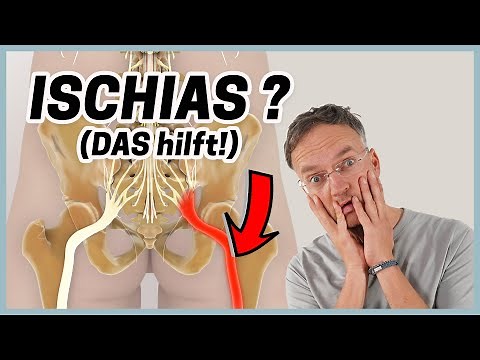 Relieve sciatica pain with these 3 exercises