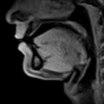 Live video of movements during speech production (MRI at 20 ms.)