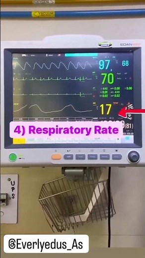 #Basics to reading a patient's monitor # Pulse, SpO2, BP, Temp ##🙂