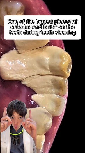 Understanding Periodontal Disease: Prevention and Treatment