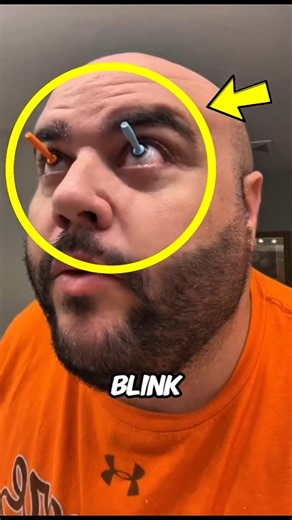 What Happens If You Stop Blinking? 😳 Your Eyes Won't Last Long!