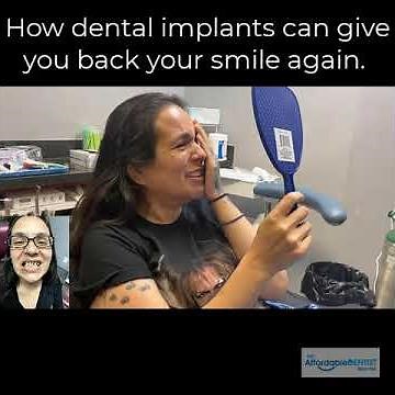 Dental Implants Before and After - Affordable Dentist Near Me