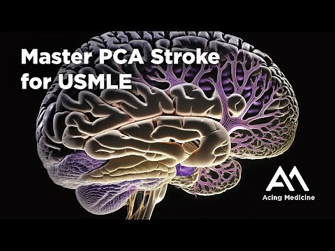 Master PCA Stroke for USMLE | Key Concepts & High-Yield Facts by Acing Medicine