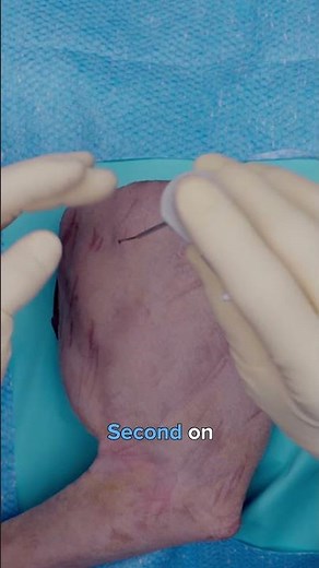 Transforming Veterinary Medicine With the Arthrex NanoScope™ Operative Arthroscopy System