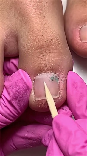 Watch this satisfy “Deep Nail Cleansing Tutorial asmr