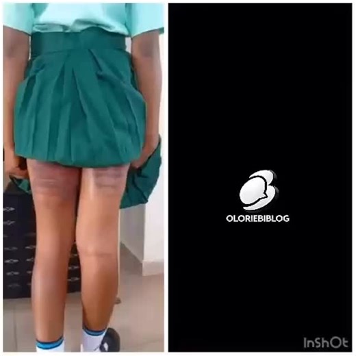Call for justice after SS3 student was allegedly beaten brutally at Command secondary school lyana Ipaja Concerned individuals are calling for urgent intervention following allegations that an SS3 student, Maryiane Okonkwo, was brutally beaten by a school bursar identified as Farouk Ohieari at Command Secondary School, lyana Ipaja. According to reports circulating online, the student was allegedly assaulted on school premises. It is further claimed that the school has refused to release her to h