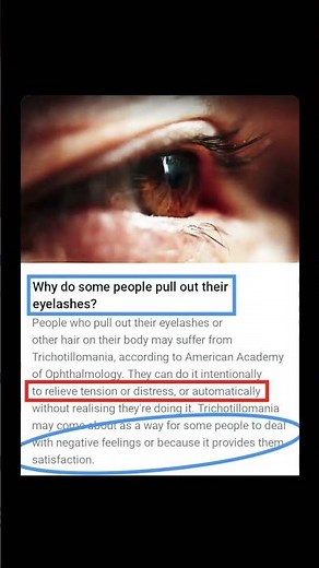 Pulling eyelashes isn’t a habit — it’s a mental health signal