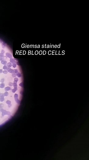 Giemsa Stained Red blood cells under the microscope at 1000x magnification #laboratory #medtechstudent #cls #mls #lab #bloodcells #hematology #fyp #foryou #fypシ #fypシ゚viral a