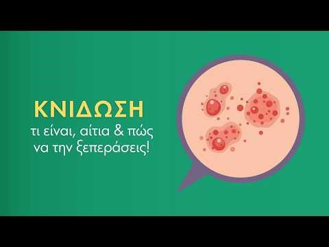 Κνίδωση: τι είναι, αίτια & πώς να την ξεπεράσεις!