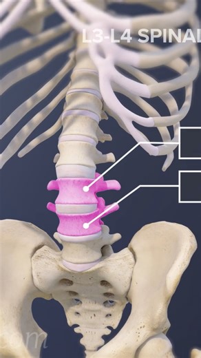 Want to understand your L3-L4 spinal motion segment? 🧠💪 This video breaks down the anatomy, function, and common issues like herniated discs, nerve compression, and lower back pain. Learn how this crucial part of your lumbar spine affects movement, posture, and everyday life. Perfect for students, patients, or anyone curious about spine health! | Spine-health
