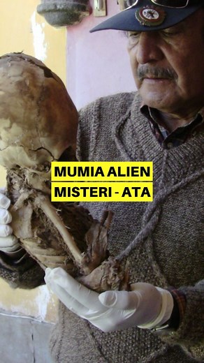 Mumia Alien Misteri - ATA What’s up TrueGeng, Saya Dollah Vitiligo content creator anda 😺 Dan ini semua social media saya yang lain: “Youtube” Video Panjang Spacedollah: https://www.youtube.com/@spacedollah Instagram: https://www.instagram.com/truedollah/ Twitter: https://twitter.com/truedollah Terima kasih sb sudi Support channel ini, Saya harap anda semua happy dan bahagia di mana jua! Untuk informasi yang lebih detail: https://www.nationalgeographic.com/history/article/chile-mummy-ata-alien-