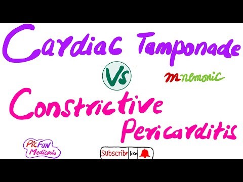 Cardiac Tamponade Vs Constrictive Pericarditis