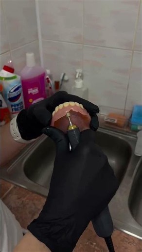 Types of Dental Dentures 🦷 Explained Simply #shorts #dentist #dentistry #dentures #dentalprosthetics