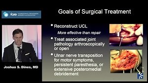Elbow Reconstruction: MCL Reconstruction: Indications, Technique, and Results