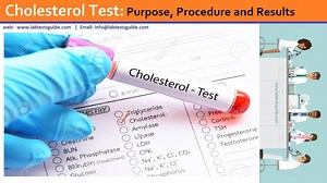 Cholesterol | Lab Tests Guide