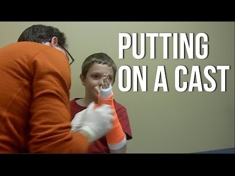 Putting On A Cast - Short Arm Cast