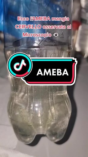 Ameba Mangia Cervello: Osservata al Microscopio