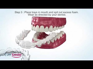 How to Clean Your Aligner or Retainer in 3 Simple Steps with WhiteFoam by EverSmile