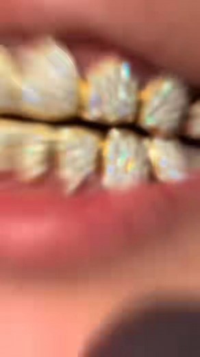 I can dip your Silver & NPG Grillz in 18k or 24K Gold . Call 4058757030 to get it started!! #goldplating #grillz #oklahomacity #blackfridaydeals #RightShyneGrillz | Right Shyne Grillz | Facebook