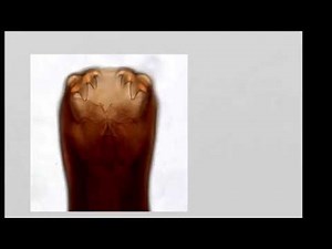 Life cycle of a hookworm