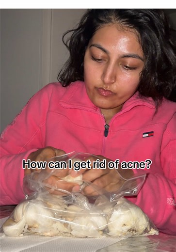 I keep getting a lot of questions asking if garlic helps with fat loss. All I know is that it’s helped clear my skin and keep it that way as long as you’re consistent! Products : C E ferulic @SkinCeuticals Glow Replenishing Rice Milk Toner @Beauty of Joseon Niacinamide serum @Biodance Store Snail Mucin @COSRX Official Exfoliating Toner @Paula’s Choice Biogenic essence @cepolab_official Tretinoin 0.05% (medically prescribed) Dewy Skin Cream @Tatcha US #skincare #acne #treatment #health #glow