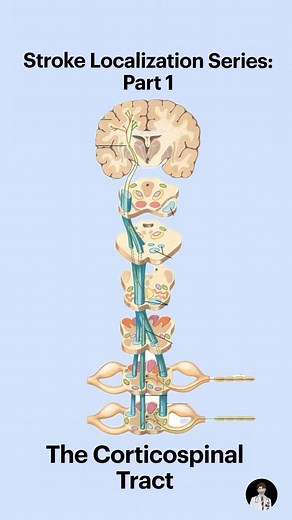 Dot Medicine on Instagram: "STROKE LOCALIZATION SERIES 🧠🩺 PART 1: The Corticospinal Tract • The corticospinal tract is responsible for transferring motor information from the cortex to the muscle, via the spinal cord. • The impulses arise from the motor cortex or the pre-central gyrus located on the frontal lobe. • The fibers form a fan shaped corona radiata which then passes through the anterior two-third of posterior limb, and genu of the internal capsule. • The fibers then pass through midd