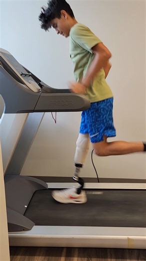 Thank you to @fillauer for partnering with us on a training session for Latin American prosthetic industry professionals! @daniel_f_113 and @irina__yeakley were amazing patient models. We look forward to seeing how yesterday's lessons will be applied with other athletes in other countries. #bettertogether #prosthetics #payitforward #running #runningblades | Amputee Blade Runners